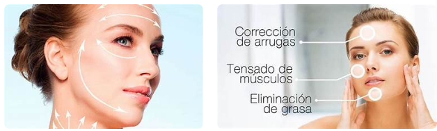 Procedimiento Quirúrgico del Estiramiento Facial